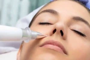 Best Actinic Keratoses Removal 3 Actinic keratoses Cirencester solutions - book in today!